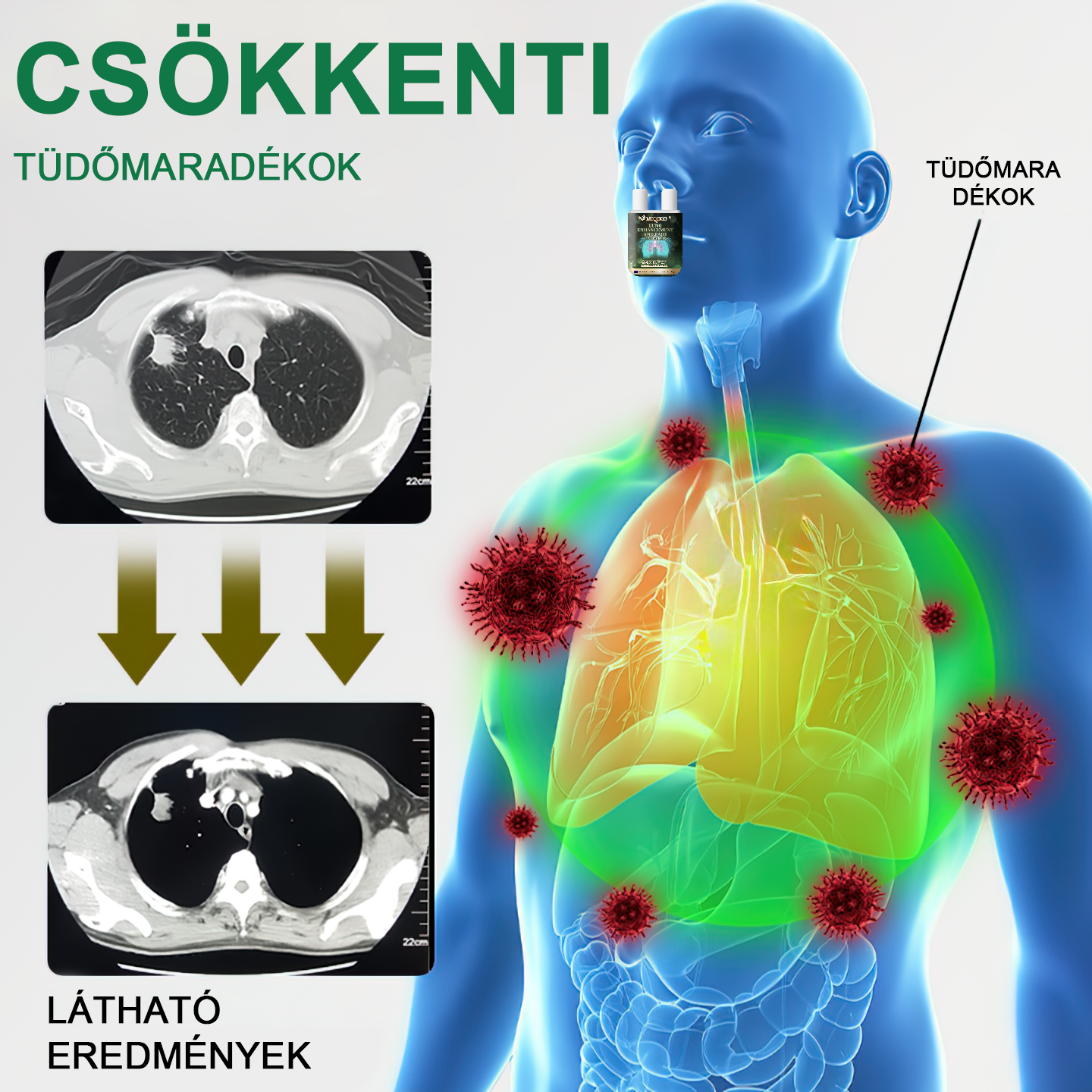 🎉【💟Készült és szállított az Egyesült Királyságban✅】👨‍⚕️𝐌𝐈𝐐𝐈𝐊𝐎® Lung Javító és ápoló inhalátorok (🌈Tüdőszakértő ajánlott🌈)