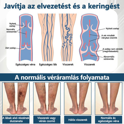 💧ATTDX® Növényi ödéma enyhítő krém nigellával