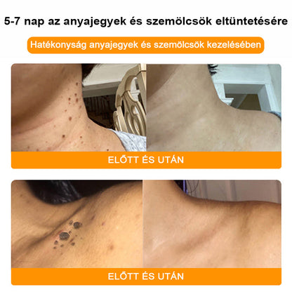 🐝✨𝑩𝑺𝑾𝑬𝑳𝑳® 𝑴é𝒉𝒎é𝒓𝒆𝒈 𝑲𝒆𝒛𝒆𝒍é𝒔 𝑲𝒓é𝒎👨‍⚕️（𝑫𝒆𝒓𝒎𝒂𝒕𝒐𝒍ó𝒈𝒖𝒔 𝒂𝒋á𝒏𝒍á𝒔𝒐𝒌） (🔥𝒖𝒕𝒐𝒍𝒔ó 𝒏𝒂𝒑 𝒑𝒓𝒐𝒎ó𝒄𝒊ó 80% 𝒌𝒊）