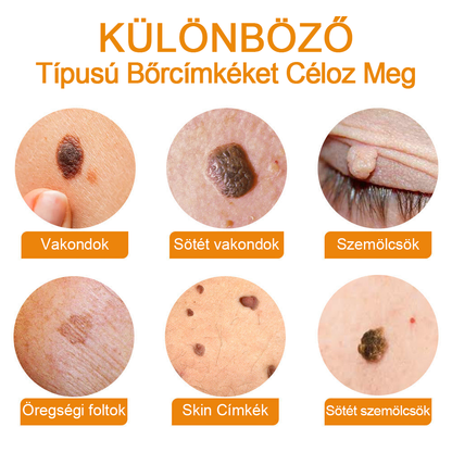 🍯👑BENETURE™ méhméreg szemölcs és anyajegy eltávolító krém (Utolsó napi akció, 80% kedvezmény)