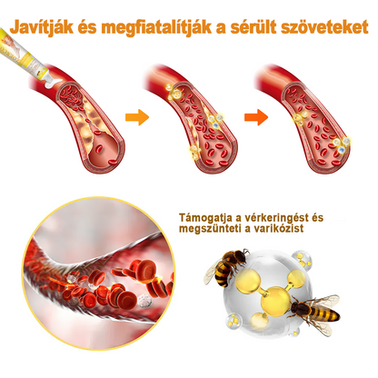 🏆🌈Zoencgz™ méhméreg ízületi gyulladás és visszér kezelő krém✨