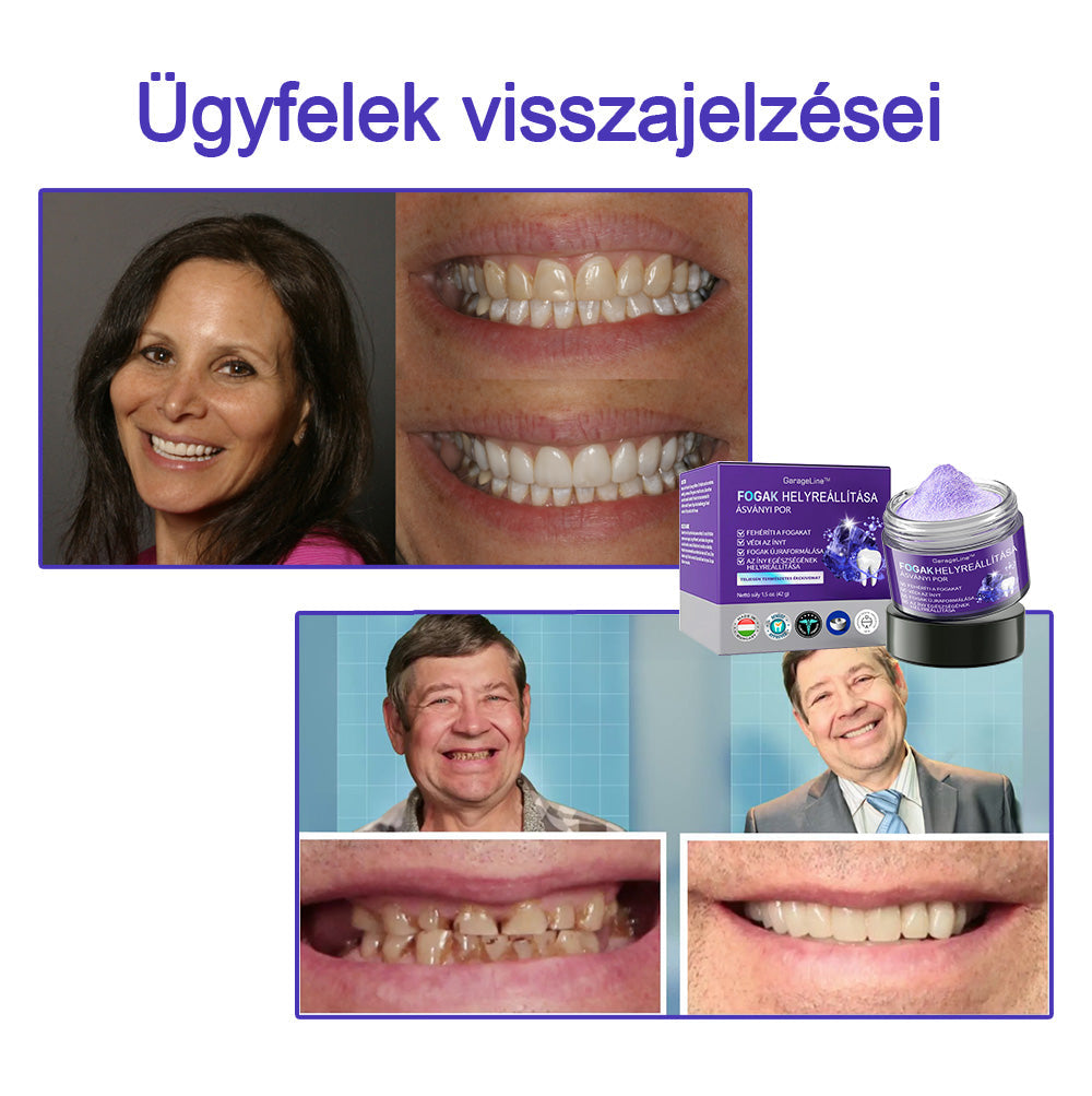 𝖦𝖺𝗋𝖺𝗀𝖾𝖫𝗂𝗇𝖾™ 𝖥𝗈𝗀𝖺𝗄 𝗁𝖾𝗅𝗒𝗋𝖾á𝗅𝗅í𝗍á𝗌𝖺 Á𝗌𝗏á𝗇𝗒𝗂 𝗉𝗈𝗋🦷 (MFK által ajánlott) (👨🏻‍⚕️(Korlátozott idejű ajánlat - ne hagyja ki)👨🏻‍⚕️)