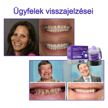 𝖦𝖺𝗋𝖺𝗀𝖾𝖫𝗂𝗇𝖾™ 𝖥𝗈𝗀𝖺𝗄 𝗁𝖾𝗅𝗒𝗋𝖾á𝗅𝗅í𝗍á𝗌𝖺 Á𝗌𝗏á𝗇𝗒𝗂 𝗉𝗈𝗋🦷 (MFK által ajánlott) (👨🏻‍⚕️(Korlátozott idejű ajánlat - ne hagyja ki)👨🏻‍⚕️)