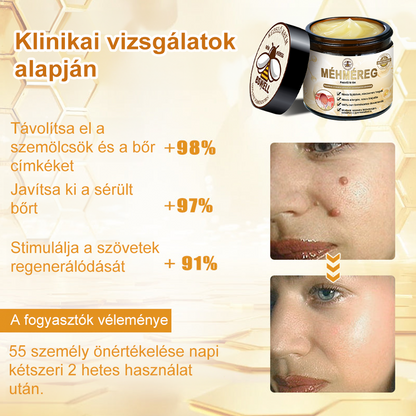 🐝✨𝑩𝑺𝑾𝑬𝑳𝑳® 𝑴é𝒉𝒎é𝒓𝒆𝒈 𝑲𝒆𝒛𝒆𝒍é𝒔 𝑲𝒓é𝒎👨‍⚕️（𝑫𝒆𝒓𝒎𝒂𝒕𝒐𝒍ó𝒈𝒖𝒔 𝒂𝒋á𝒏𝒍á𝒔𝒐𝒌） (🔥𝒖𝒕𝒐𝒍𝒔ó 𝒏𝒂𝒑 𝒑𝒓𝒐𝒎ó𝒄𝒊ó 80% 𝒌𝒊）