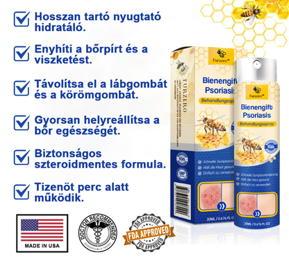 👨‍⚕Furzero™ Psoriasis Treatment Spray-t a viszketés és a gyulladás csökkentése érdekében 2 hét után. (Dr. Károlyi Krisztina: hiteles ajánlás)