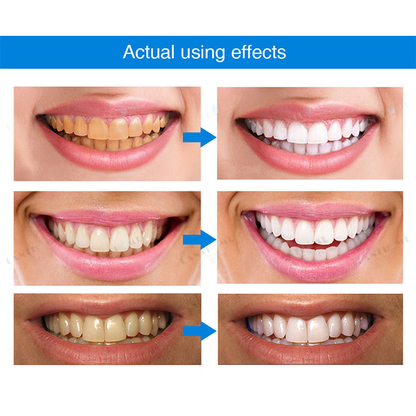 ⏳Limited Time Offer⏳LIMETOW™ Teeth Whitening Essence