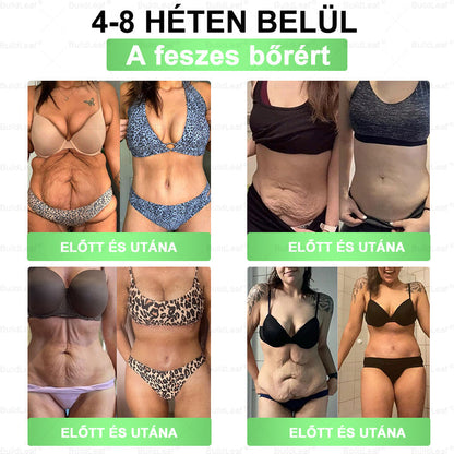 A BENU hivatalos zászlóshajó áruháza | BuildLeaf® szájon át szedhető oldat (naponta egyszer, hét napon belül hat) ✅ Támogatja a testsúlyszabályozást, a szív egészségét, a cukorbetegség kezelését, a bélrendszer egészségét és a nők egészségét 🌿🌿